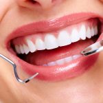 dental check-up